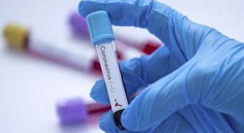В Україні зафіксовано 673 нових випадки коронавірусної хвороби COVID-19