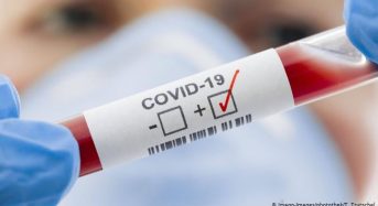 Захворювання на коронавірус 8 квітня виявили в 1265 жителів Київщини