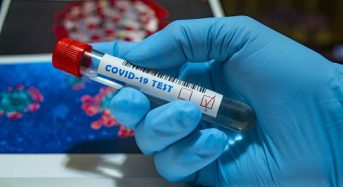 Захворювання на коронавірус виявили в 208 жителів Київщини