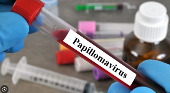 Що таке ВПЛ?